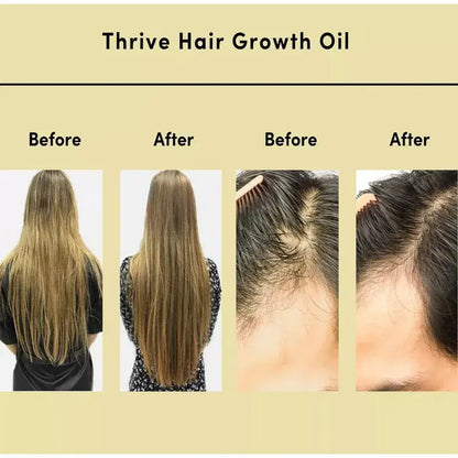 ThriveX Hair Growth Oil: 100% Natural Hair Thickening & Growth Solution -100ml - Qobeyhub