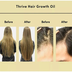 ThriveX Hair Growth Oil: 100% Natural Hair Thickening & Growth Solution -100ml - Qobeyhub